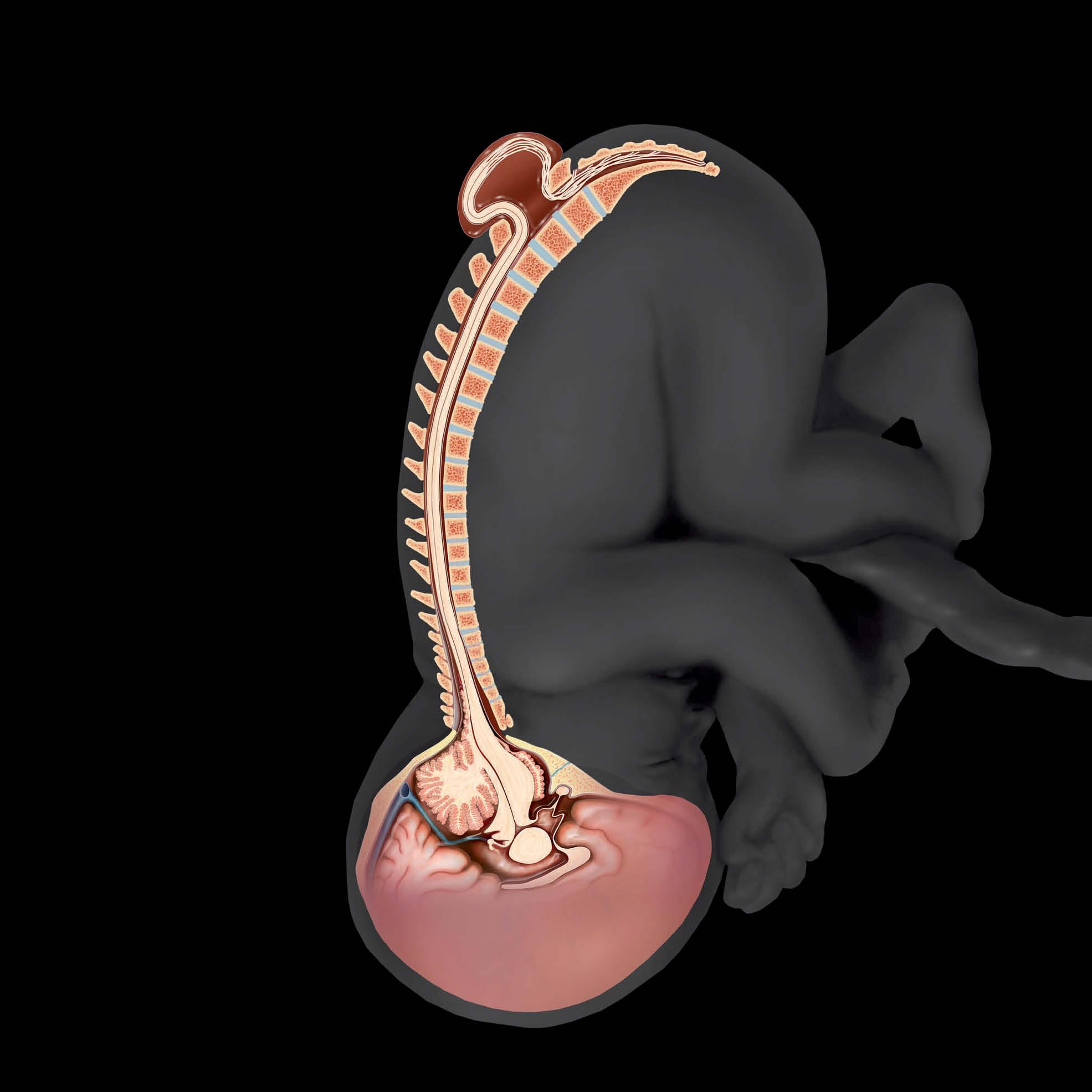 Diagnostic Imaging Obstetrics 第三版 Amazon | Diagnostic Imaging: Obstetrics, 3e | Woodward MD