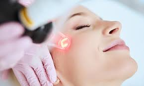 Cover for How Does Laser Treatment For Face Promote Natural Collagen?