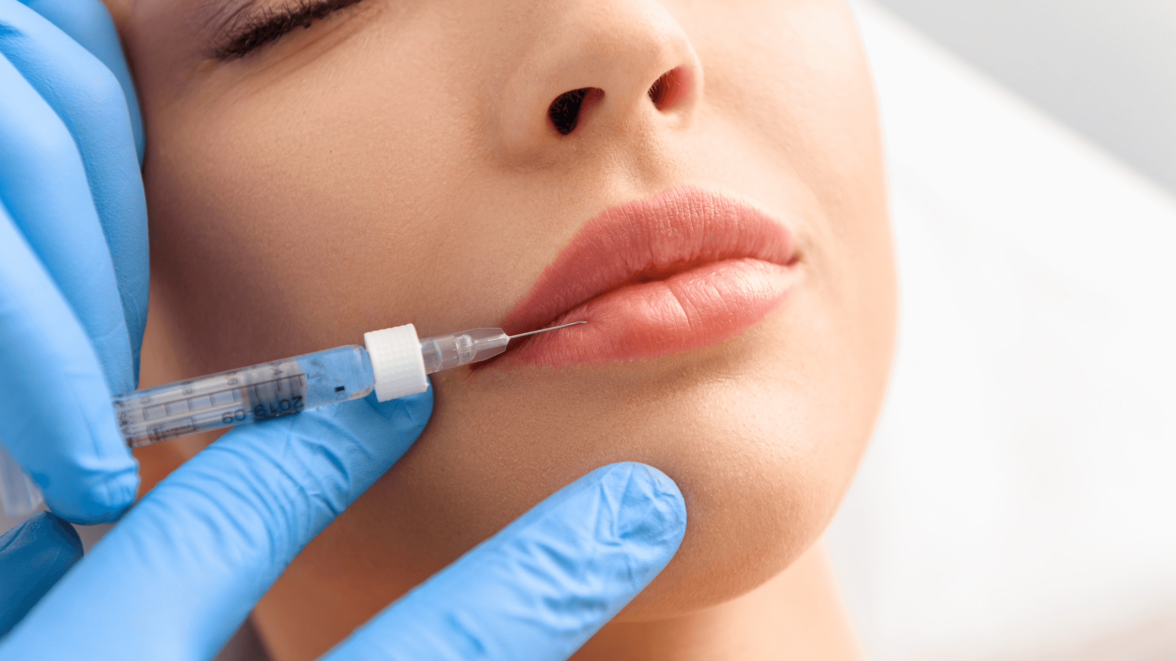 Cover for How Does Volbella Filler Address Lines Around the Lips?